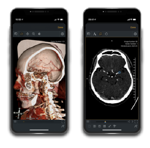 Neurology app