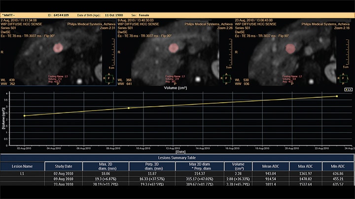 IntelliSpace Portal Whitepaper MMTT 2 L