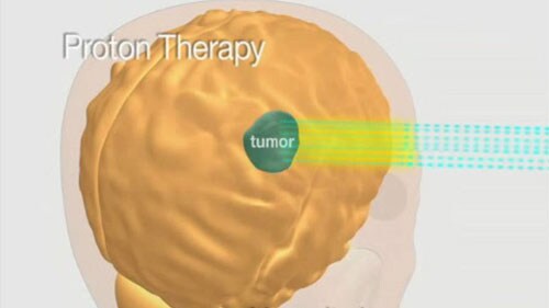 proton therapy nodose L new