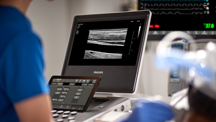 Philips’ intelligent end-to-end ultrasound innovations take center stage at the Ultrasound World Congress – enabling more confident decision making, for more people in more places