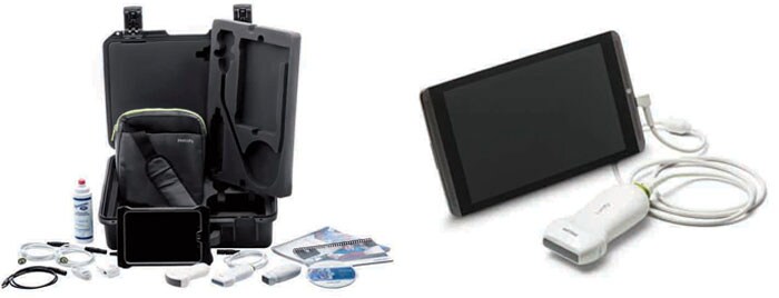 First App-Based Portable Ultrasound System in Kenya